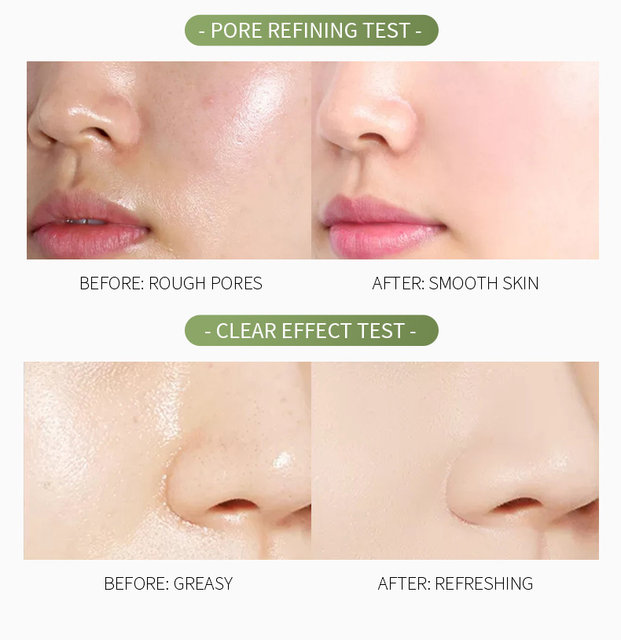 FENYI Green Tea Mud Mask 100g - Image 6