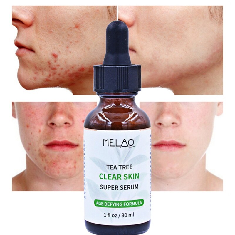 Melao tea tree clear skin super serum 30 ml - Image 2