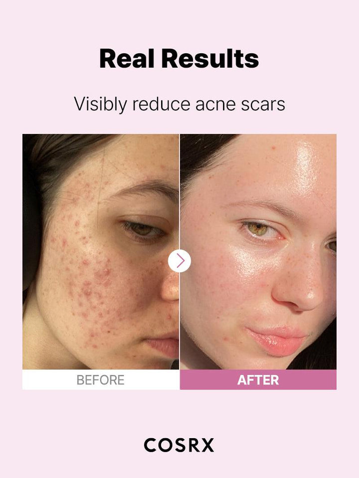 COSRX The Niacinamide 15 Serum - Image 3