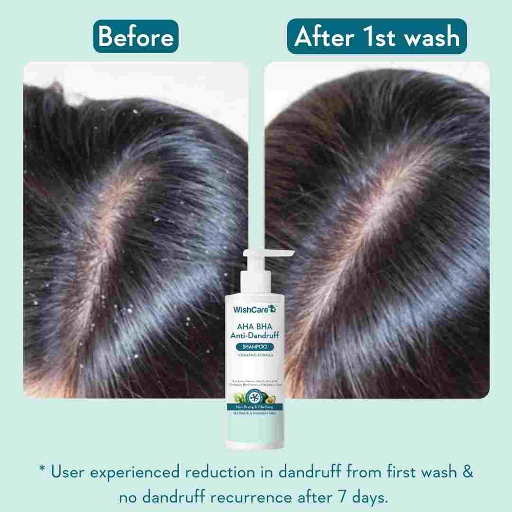 WishCare AHA BHA Anti-Dandruff Shampoo - 250ml - Image 2